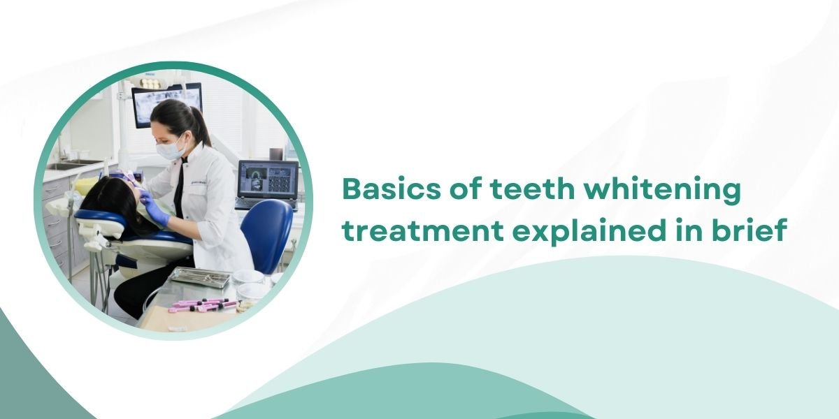 Basics of teeth whitening treatment explained in brief