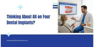Thinking About All on Four Dental Implants? Read This First