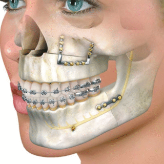 Maxillofacial Surgery Options and Care Available in Dubai