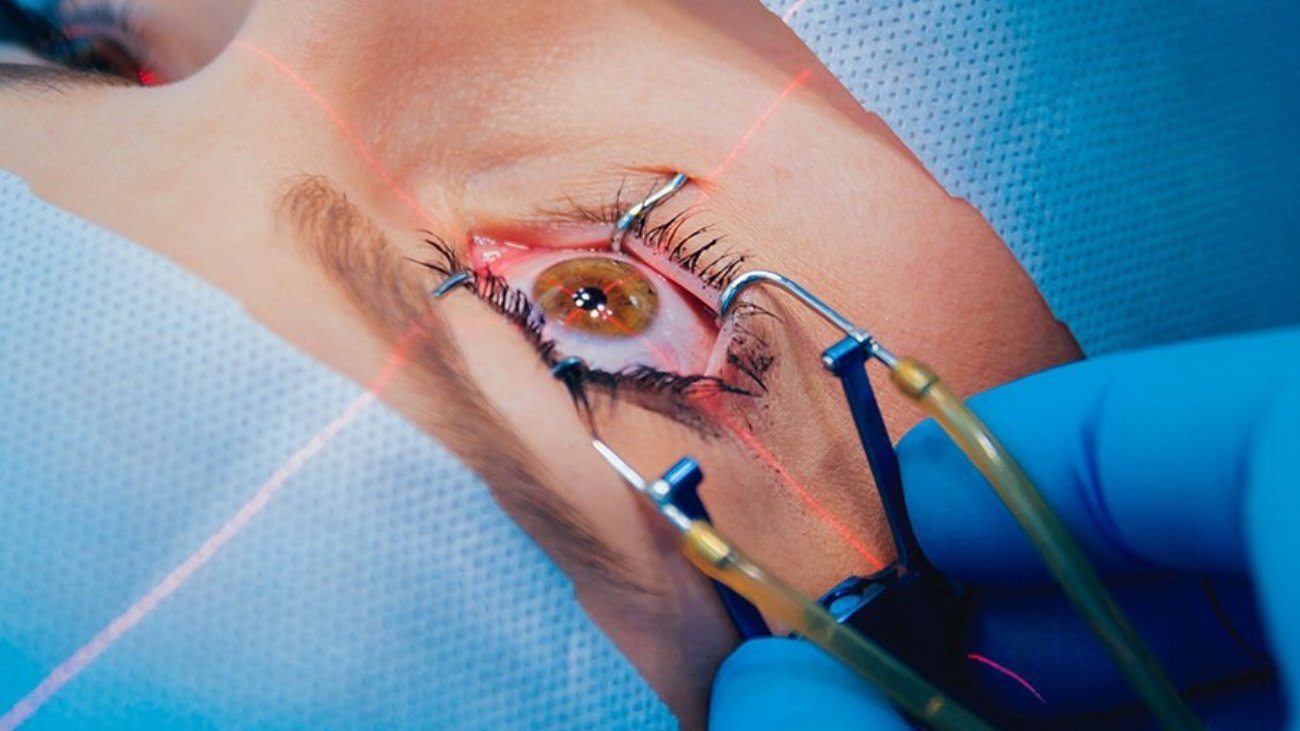 Experienced Eye Surgeon in Dubai for Safe Vision Care