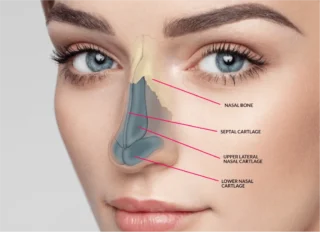 Cost and Recovery Details of the Best Rhinoplasty in Dubai