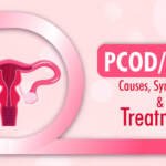 PCOD/PCOS Causes, Symptoms, and Treatment