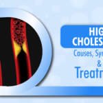 High Cholesterol: Symptoms, Causes and Treatment