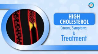 High Cholesterol: Symptoms, Causes and Treatment