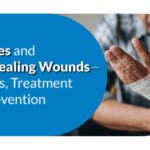 Diabetes and Wound Healing: Reasons, Treatment and Prevention