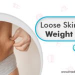 Understanding Loose Skin After Weight Loss