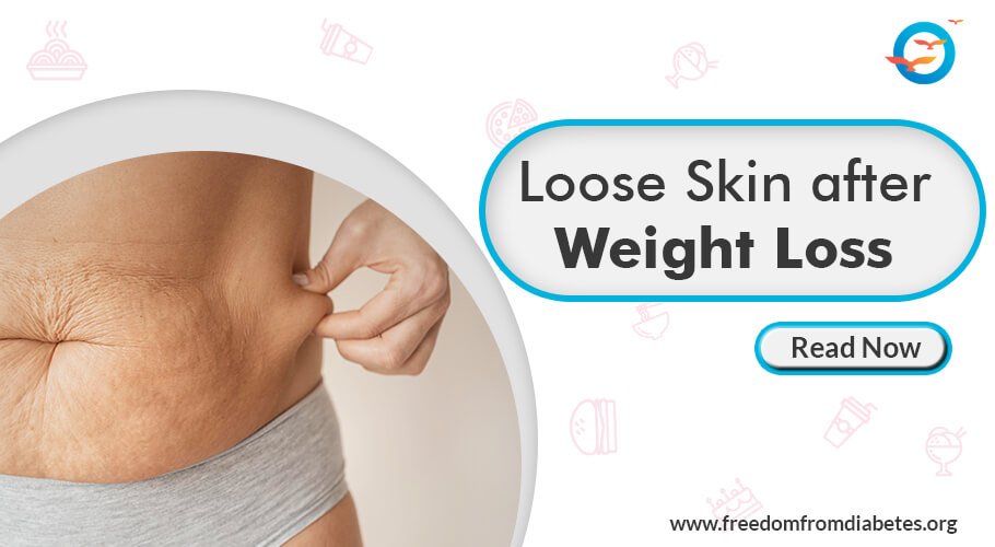 Understanding Loose Skin After Weight Loss