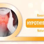How to Reverse Hypothyroidism Naturally?