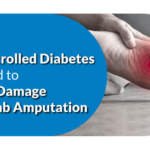 How Uncontrolled Diabetes Can Lead to Nerve Damage and Limb Amputation?
