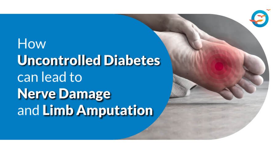 How Uncontrolled Diabetes Can Lead to Nerve Damage and Limb Amputation?