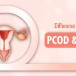 Difference Between PCOD & PCOS