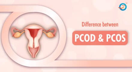 Difference Between PCOD & PCOS