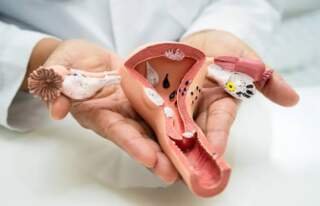 Finding an Endometriosis Specialist Dubai for Ongoing Care